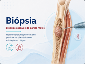 Biópsias ósseas e de partes moles Procedimentos diagnósticos que precisam ser planejados com estratégia oncológica.
