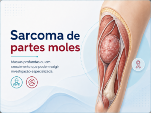 Sarcomas de partes moles Massas profundas ou em crescimento que podem exigir investigação especializada.